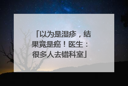 以为是湿疹，结果竟是癌！医生：很多人去错科室